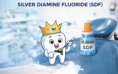 Silver Diamine Fluoride (SDF) For Kids: A Gentle, Drill-Free Option for Cavities