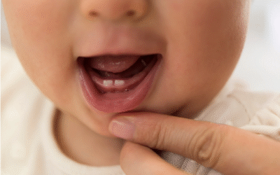 When Should My Child First See the Dentist?