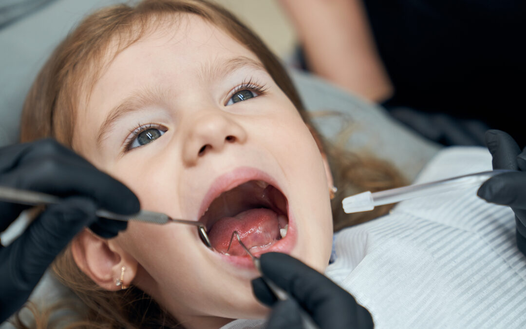 Baby Teeth: Why They Matter Even Though They Fall Out
