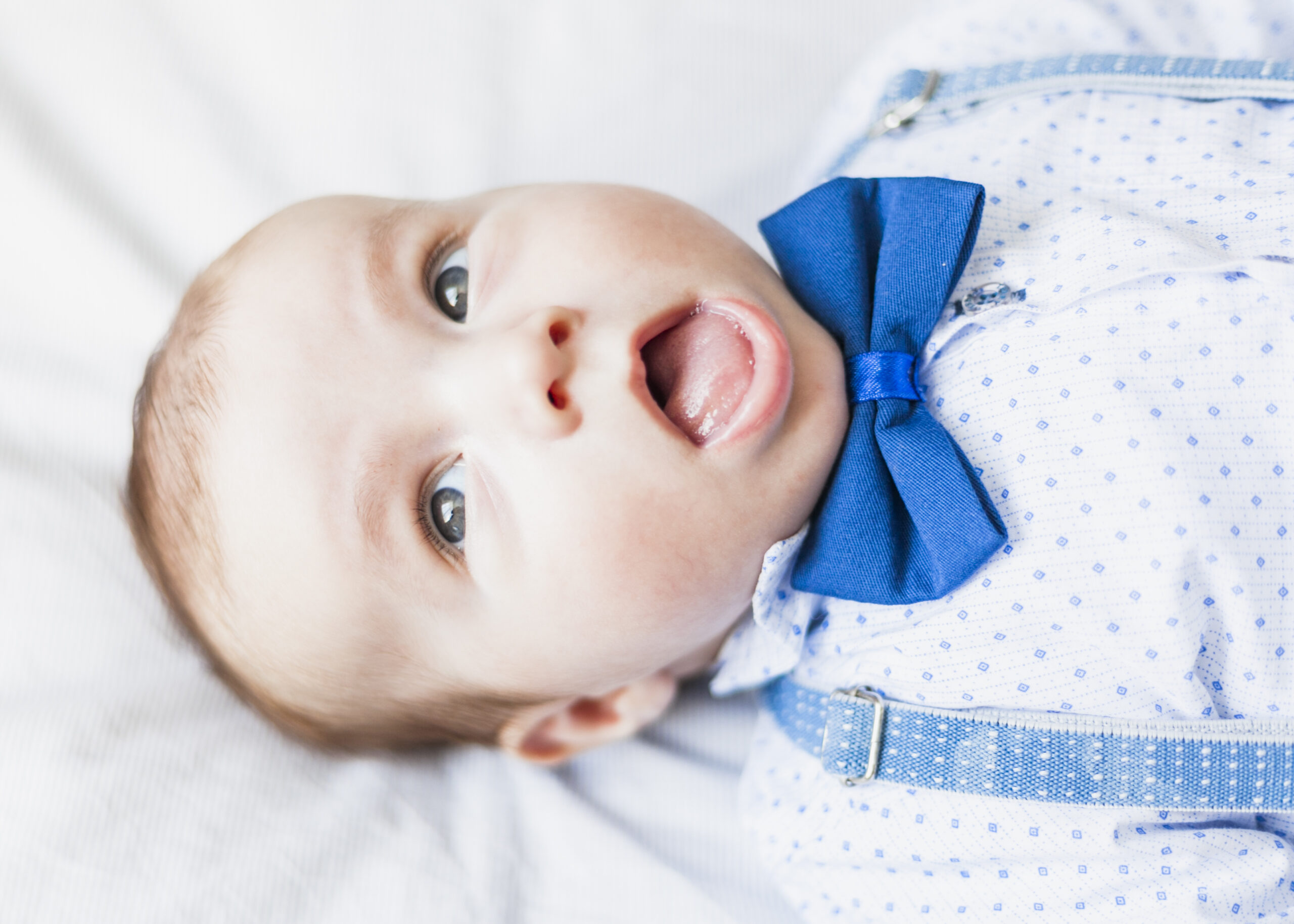 Tongue tie in children Tongue Tie in Children